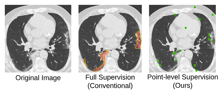 A Weakly Supervised Consistency-based Learning Method for COVID-19 Segmentation in CT Images 